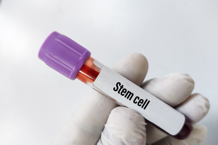 変形性膝関節症　再生医療