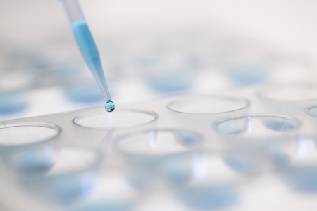 変形性膝関節症　再生医療