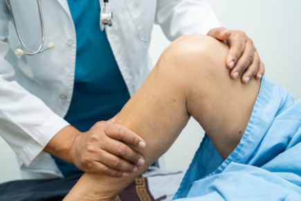 変形性膝関節症　４０代