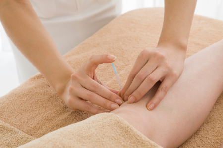 変形性膝関節症 鍼灸治療