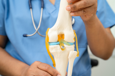 変形性膝関節症　評価